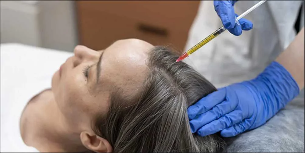 Read more about the article What You Need to Know About PRP Therapy